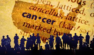 U.S. Cancer Rates Reach Milestone as Deaths Decline for All Four Major Cancer Sites U.S. Cancer Rates Reach Milestone as Deaths Decline for All Four Major Cancer Sites