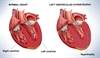 Heart Failure During Breast Cancer Management: A Case Study Heart Failure During Breast Cancer Management: A Case Study