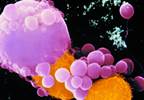The Promise of PD-1/PD-L1 Antagonists in Treating Metastatic Melanoma The Promise of PD-1/PD-L1 Antagonists in Treating Metastatic Melanoma