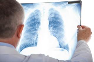 Afatinib may demonstrate clinical activity in patients with EGFR mutation-positive non-small cell lung cancer and brain metastasis. Afatinib may demonstrate clinical activity in patients with EGFR mutation-positive non-small cell lung cancer and brain metastasis.