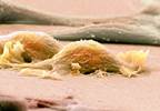 Future Treatment Modalities in Sarcoma: Insights From ASCO 2017 Future Treatment Modalities in Sarcoma: Insights From ASCO 2017