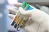 Understanding Blast Phase Chronic Myeloid Leukemia Understanding Blast Phase Chronic Myeloid Leukemia