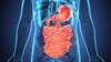 Volatile Organic Compounds and Esophageal Cancer: Understanding the Implications for Diagnosis and Treatment Volatile Organic Compounds and Esophageal Cancer: Understanding the Implications for Diagnosis and Treatment