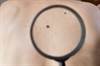 Questions Remain for First-line Treatment Selection and Sequencing in Advanced Melanoma Questions Remain for First-line Treatment Selection and Sequencing in Advanced Melanoma