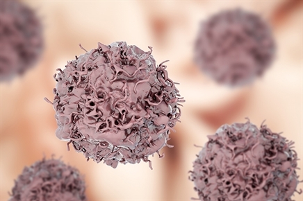 Swden cancer treatment