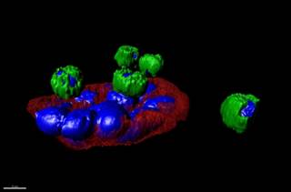 Scripps Research Institute biophysicist Peter Kuhn and colleagues have captured images of tumor cell Scripps Research Institute biophysicist Peter Kuhn and colleagues have captured images of tumor cell