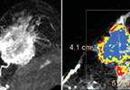 21st Century Breast Imaging 21st Century Breast Imaging