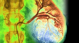 Pazopanib Safe, Effective as Second-Line Treatment for Renal Cell Carcinoma Pazopanib Safe, Effective as Second-Line Treatment for Renal Cell Carcinoma