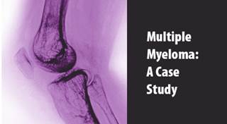 Optimal Induction Therapy for Multiple Myeloma Optimal Induction Therapy for Multiple Myeloma
