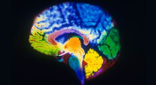 Breast Cancer and Memory Loss Breast Cancer and Memory Loss