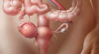 Emerging Therapies for Ovarian Cancer Emerging Therapies for Ovarian Cancer