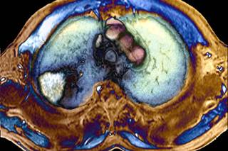 Targeted Therapies for NSCLC Enhanced Clinical Trial Success Targeted Therapies for NSCLC Enhanced Clinical Trial Success