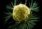 Powerful new way to treat HER2-positive breast cancer validated Powerful new way to treat HER2-positive breast cancer validated