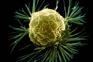 Vitamin D May Improve Breast Cancer Survival Vitamin D May Improve Breast Cancer Survival