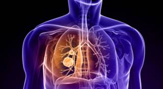 Results Announced for Ganetespib in NSCLC Trial Results Announced for Ganetespib in NSCLC Trial