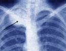 9/11 First Responders Experiencing Higher Rates of Chronic Cardiovascular, Respiratory Diseases 9/11 First Responders Experiencing Higher Rates of Chronic Cardiovascular, Respiratory Diseases
