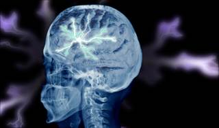 The Challenge of Managing Cancer-Associated Seizures The Challenge of Managing Cancer-Associated Seizures