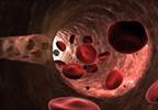 New Oral Anticoagulants: An Update Relevant to Treating Patients with Cancer New Oral Anticoagulants: An Update Relevant to Treating Patients with Cancer