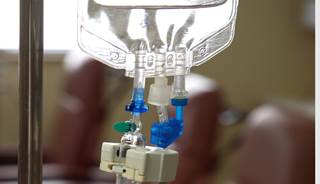 Chemo First May Be Better in Rectal Cancer Chemo First May Be Better in Rectal Cancer