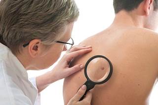 Research Targets Genetics of Melanoma Research Targets Genetics of Melanoma