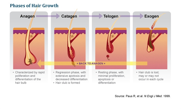 Chemotherapy Induced Alopecia (CIA)