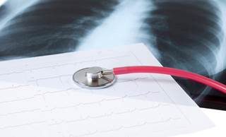 A Growing Concern Over Increased Cardiovascular Disease Risk in Breast Cancer Survivors A Growing Concern Over Increased Cardiovascular Disease Risk in Breast Cancer Survivors