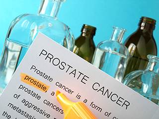 How to Discuss PSA Screening With Patients How to Discuss PSA Screening With Patients