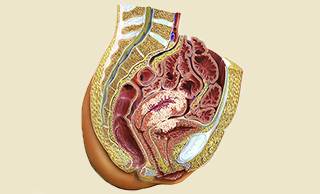Endometrial cancer / Photo credit: Science Source Endometrial cancer / Photo credit: Science Source