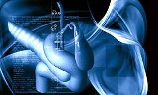 Pazopanib may be associated with response in patients with pancreatic neuroendocrine tumors but not carcinoid tumors. Pazopanib may be associated with response in patients with pancreatic neuroendocrine tumors but not carcinoid tumors.