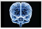 Tumor Treating Fields Improve Survival in Newly Diagnosed Glioblastoma Tumor Treating Fields Improve Survival in Newly Diagnosed Glioblastoma