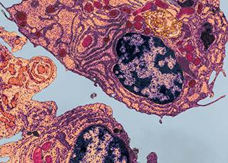 Electron micrograph of a human plasma cell from bone marrow in multiple myeloma / Phototake Electron micrograph of a human plasma cell from bone marrow in multiple myeloma / Phototake