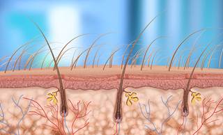 Ruxolitinib May Help Those With Alopecia Ruxolitinib May Help Those With Alopecia