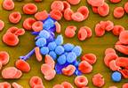 Long-Term Ibrutinib Yields Deep, Durable Responses in Chronic Lymphocytic Leukemia Long-Term Ibrutinib Yields Deep, Durable Responses in Chronic Lymphocytic Leukemia