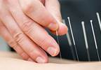 Acupuncture effectively improves appetite in patients with GI tract cancer Acupuncture effectively improves appetite in patients with GI tract cancer