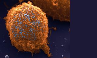 Proportion of cancer patients undergoing HIV testing varies by demographic. Proportion of cancer patients undergoing HIV testing varies by demographic.
