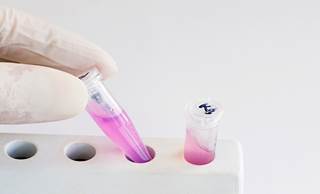 Molecular Subtyping Bests Standard in Predicting Breast Cancer Outcomes Molecular Subtyping Bests Standard in Predicting Breast Cancer Outcomes