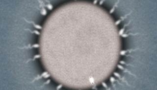 Goserelin Helps Preserve Fertility Among Women Undergoing Chemo for HR-Negative Breast Cancer Goserelin Helps Preserve Fertility Among Women Undergoing Chemo for HR-Negative Breast Cancer