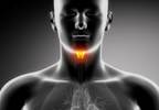 Surgery First Improves Oral Cancer Outcomes Surgery First Improves Oral Cancer Outcomes