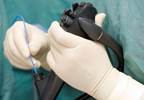 Endoscopic Celiac Nerve Block: Managing Pancreatic Cancer Pain Endoscopic Celiac Nerve Block: Managing Pancreatic Cancer Pain