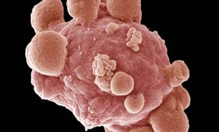 A "Game Changer" in ALL and CLL? A "Game Changer" in ALL and CLL?