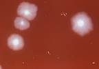 Neutropenic Enterocolitis: What to Expect Neutropenic Enterocolitis: What to Expect