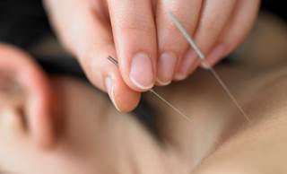 Acupuncture Effective for Hot Flashes Acupuncture Effective for Hot Flashes