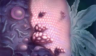 New Study May Pave Way for Detecting Ovarian Cancer Earlier New Study May Pave Way for Detecting Ovarian Cancer Earlier