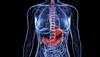 Can Treatments for Childhood ALL Alter the Gut Microbiome? Can Treatments for Childhood ALL Alter the Gut Microbiome?