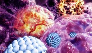 Might Nano-oncology Resurrect Old Anticancer Drugs? Might Nano-oncology Resurrect Old Anticancer Drugs?