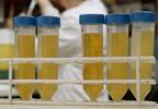 Can Stool DNA Testing Improve CRC Screening? Can Stool DNA Testing Improve CRC Screening?