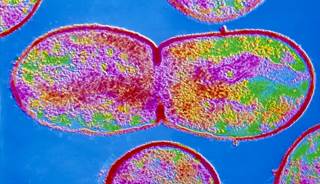 The Link Between Streptococcus bovis and CRC The Link Between Streptococcus bovis and CRC
