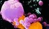 The Promise of PD-1/PD-L1 Antagonists in Treating Metastatic Melanoma The Promise of PD-1/PD-L1 Antagonists in Treating Metastatic Melanoma