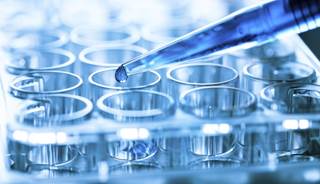 Oncogenic Drivers ID'd in Many Lung Cancers Oncogenic Drivers ID'd in Many Lung Cancers