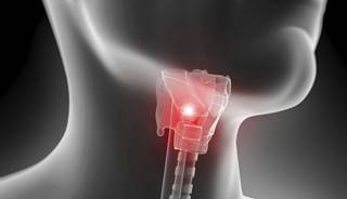 Head and Neck Cancer Knowledge Low Among US Adults Head and Neck Cancer Knowledge Low Among US Adults